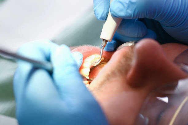 Best Holiday Emergency Dentist in Mocksville, NC