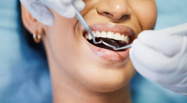 Best Emergency Dental Extractions in Mocksville, NC