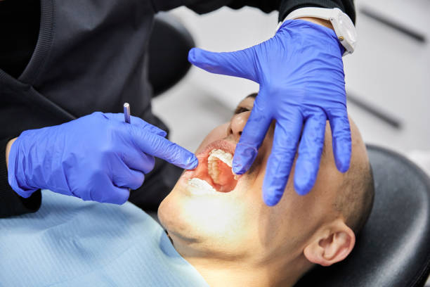 Best Broken or Cracked Tooth Emergency Dentist in Mocksville, NC