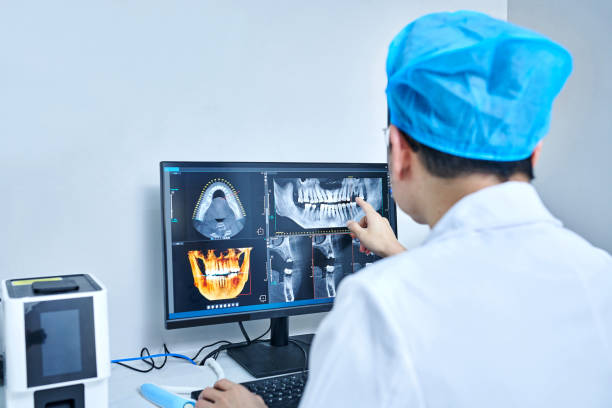 Best Emergency Dentist for Lost Fillings or Crowns in Mocksville, NC