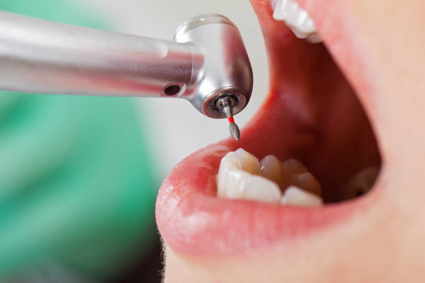 Best Orthodontic Emergency Dentist in Mocksville, NC